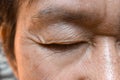 Wrinkles around closed eye of Asian elder man