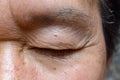 Wrinkles around closed eye of Asian elder man