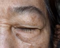 Wrinkles around closed eye of Asian elder woman