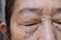 Wrinkles around closed eye of Asian elder woman