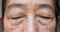 Wrinkles around closed eye of Asian elder woman