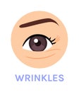 Wrinkles Around the Eye. Skin Problem. Tired Eye. Close up of Eye. Color Cartoon Style. White background. Vector illustration for