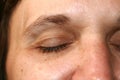 Wrinkles around the eye. Wrinkles on woman face skin. Royalty Free Stock Photo