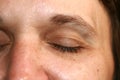 Wrinkles around the eye. Wrinkles on woman face skin. Royalty Free Stock Photo