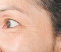 Wrinkles around the eyes and skin problems.