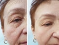 Wrinkles elderly woman face concept before and after cosmetic procedures, therapy, anti-aging Royalty Free Stock Photo