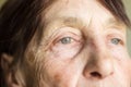 Photo eyes with age-related changes. portrait close-up of a pensioner aged 77.