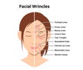 Wrinkles face and wrinkle-free face ( female face ) vector illustration Royalty Free Stock Photo