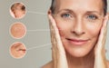 Wrinkles and skin imperfection Royalty Free Stock Photo