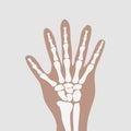 Wrist hands bones Royalty Free Stock Photo