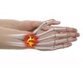 Wrist Pain - Studio shot with 3D illustration isolated on white