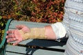 Wrist splint strapping for Repetitive strain injury.