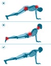 Wrong and correct plank pose. Right and wrong execution technique of sport exercise. Common mistakes in sport workout.