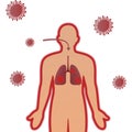 Wuhan coronavirus covit 19 related , human character, lungs infection or defected virus lungs and bacteria dangerous for