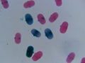Pea Pollen 400x Pink and Blue