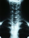 X-ray