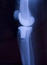 X-ray Royalty Free Stock Photo