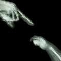 X-ray adult's hand point finger at upper side and baby's hand at lower side Royalty Free Stock Photo