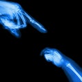 X-ray adult's hand point finger at upper side and baby's hand at lower side Royalty Free Stock Photo
