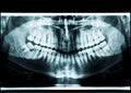 X-ray atm Royalty Free Stock Photo