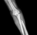 X-ray of broken arm