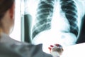 X-ray, bronchitis check, doctor with lung picture in medical clinic Royalty Free Stock Photo