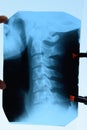 X-ray of the cervical vertebrae. X ray image of the cervical spine Royalty Free Stock Photo