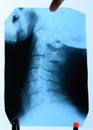 X-ray of the cervical vertebrae. X ray image of the cervical spine Royalty Free Stock Photo