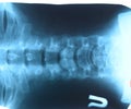X-ray of the cervical vertebrae. X ray image of the cervical spine