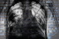 X-ray of chest on the brick wall, concept of social trouble