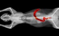 X-ray CT scan of a cat large intestine