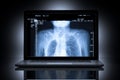 X-Ray CT Scan Computer Healthcare Royalty Free Stock Photo