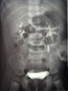 X-ray diagnostics/kidney