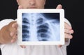 X-ray on the digital tablet Royalty Free Stock Photo