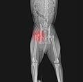 X-ray of dog pelvis. Dislocation head femur thigh bone