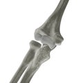 X-ray Elbow Bones Royalty Free Stock Photo