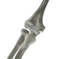 X-ray Elbow Bones