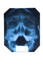 X-ray of face and maxillary sinuses