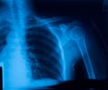 X-ray film Royalty Free Stock Photo