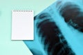 X-Ray film image of human chest for a medical diagnosis and empty blank notepad page on blue hospital table. Flat lay top view Royalty Free Stock Photo