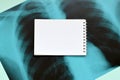 X-Ray film image of human chest for a medical diagnosis and empty blank notepad page on blue hospital table. Flat lay top view Royalty Free Stock Photo