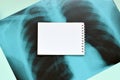 X-Ray film image of human chest for a medical diagnosis and empty blank notepad page on blue hospital table. Flat lay top view Royalty Free Stock Photo