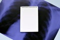X-Ray film image of human chest for a medical diagnosis and empty blank notepad page on blue hospital table. Flat lay top view Royalty Free Stock Photo