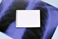 X-Ray film image of human chest for a medical diagnosis and empty blank notepad page on blue hospital table. Flat lay top view Royalty Free Stock Photo