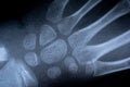 X-ray film skeleton human arm. health medical anatomy body concept