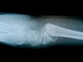 X-ray film skeleton human arm. health medical anatomy body concept