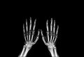 Hand x-ray on black background Royalty Free Stock Photo