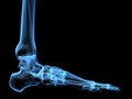 X-ray foot