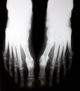 X-ray of foot Royalty Free Stock Photo