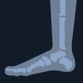 Joint anatomy. x-ray of the foot skeleton. Human leg bones. Royalty Free Stock Photo